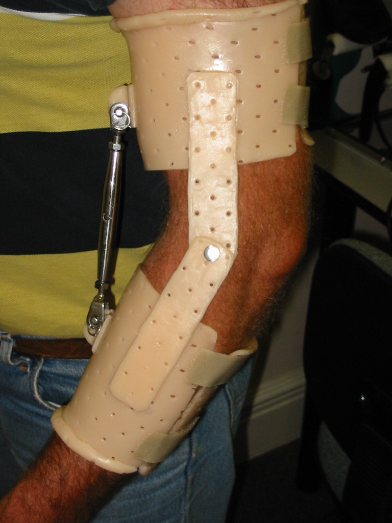 Referals-hand-therapy.jpg