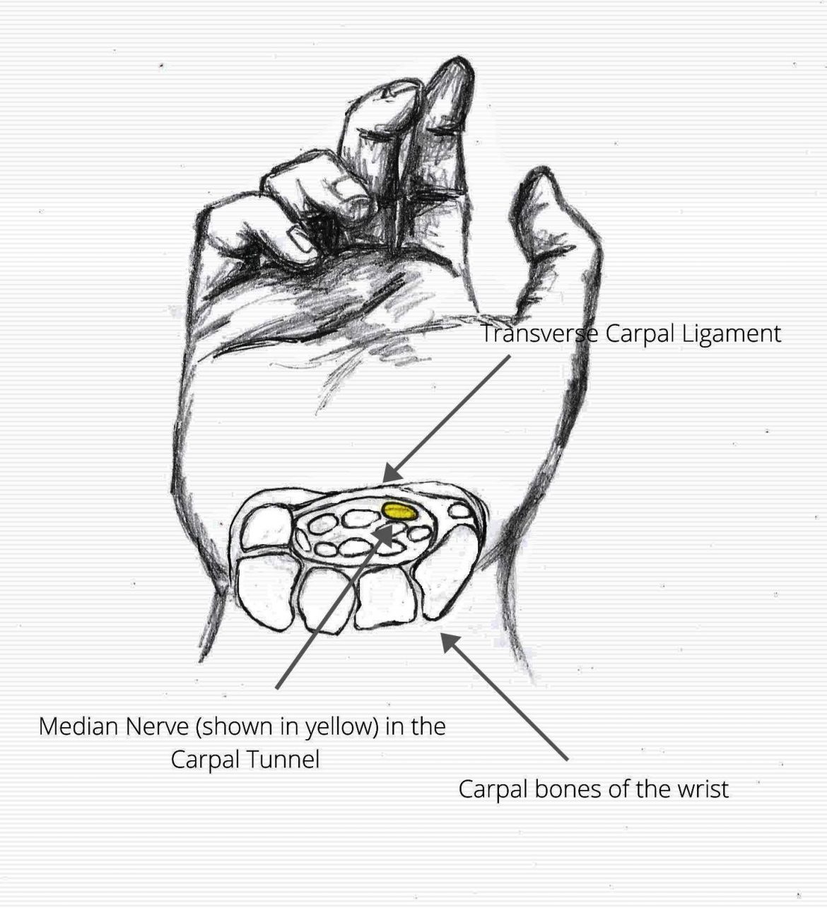 Carpal-Tunnel-with-labels.jpg